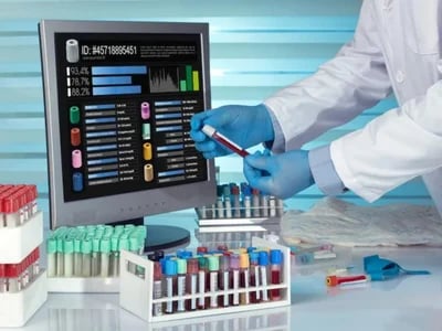 LIMS Software: Automatisierung und Transparenz in einem Tool